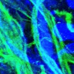 Credit: Daniyal Jafree / Lymphatic infiltration into kidney medulla